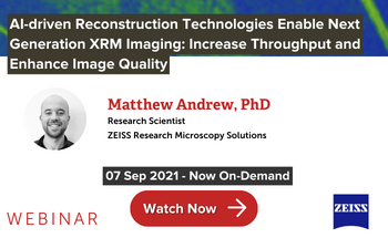 AI-driven Reconstruction Technologies Enable Next Generation XRM Imaging: Increase Throughput and Enhance Image Quality